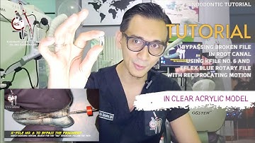 BYPASSING SEPARATED ENDODONTIC INSTRUMENT IN ROOT CANAL: A TUTORIAL IN ACRYLIC TOOTH MODEL 🦷