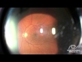 Video Image