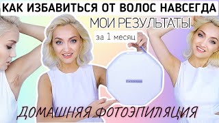 УДАЛЕНИЕ ВОЛОС НАВСЕГДА ДОМА| МОИ РЕЗУЛЬТАТЫ через МЕСЯЦ | ФОТОЭПИЛЯТОР ILUMINAGE Precise Touch Pro