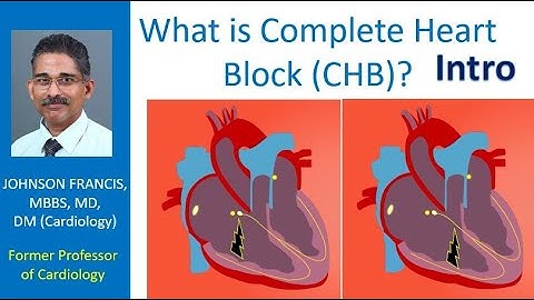 What is Complete Heart Block? Intro