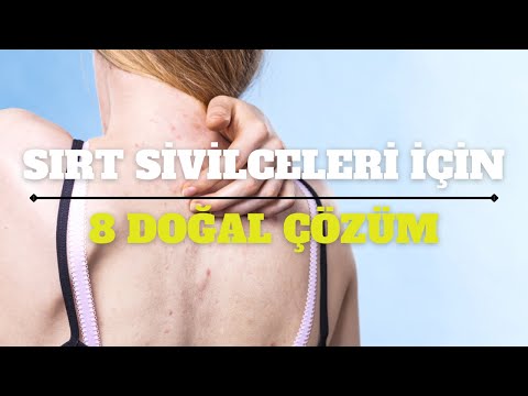 Sırtta Sivilce Neden Çıkar, Nasıl Geçer? Sırt Sivilcelerine İyi Gelen 8 Doğal Çözüm