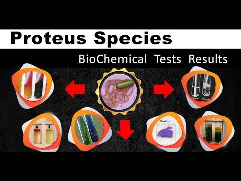 Video: Di mana Anda mendapatkan proteus mirabilis?