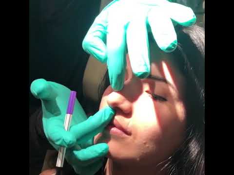 Video thumbnail: Ethnic Rhinoplasty - VLOG Consultation | NY Plastic Surgeon, Dr. Rizk · Dr. Sam Rizk