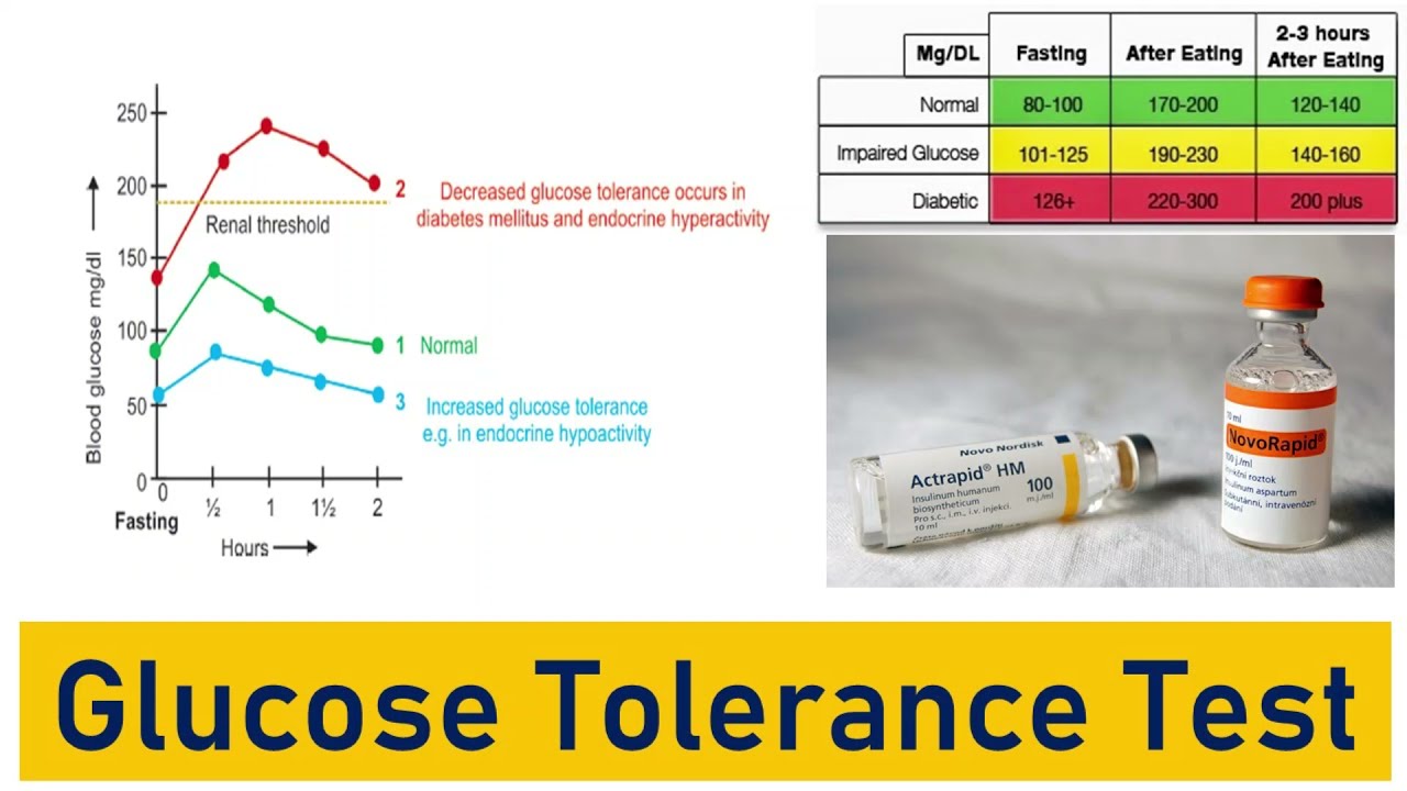 Glucose Tolerance Test [Ogtt, Igtt]: Glucose Tolerance Curve, Typical Values And The Impact