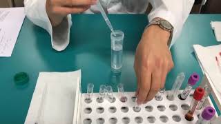 간접 항글로불린 검사(Indirect Antiglobulin test)