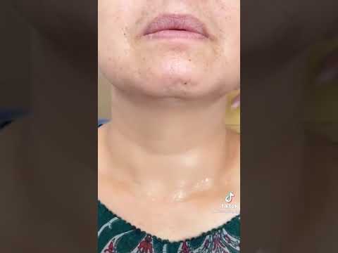 سر جمال الممثلات التركيه