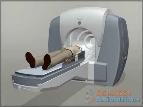 What Gamma Knife Treatment