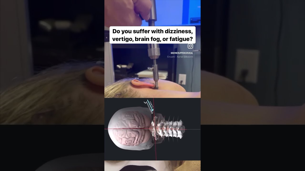 Do You Suffer With Dizziness Brain Fog Vertigo Or Fatigue Orthospinologyl Chiropractor
