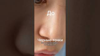 Черные точки. Сальные нити. Сальные пробки. Как ухаживать за кожей? Кислоты, глина, уход, Lagom