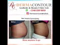 Non surgical liposculpting/bodycontouring at Derma Contour Aesthetic Clinic Abuja Nigeria 🇳🇬