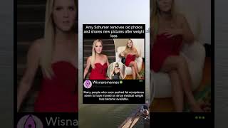 Amy Schumer Shares New Photos After Weight Loss