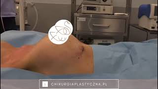 Paweł Szychta-48