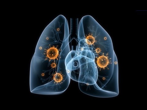 Virus və bakterial infeksiyaları.Öskürək. | Вирусные и бактериальные инфекции. Кашель. Virus və bakterial infeksiyaları.Öskürək. | Вирусные и бактериальные инфекции. Кашель.