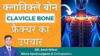 clavicle bone fracture treatment in Hindi | broken collar bone | clavicle bone | clavicle fracture .
