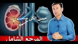 نصيحتي لتجنب حصى الكلى- دكتور بيرج