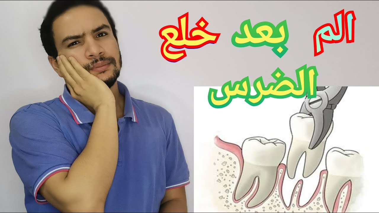 مده بقاء الالم بعد خلع الضرس و نصائح لتقليل الم بعد الخلع