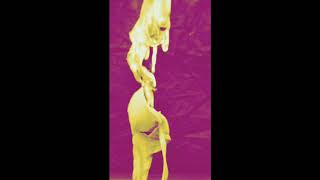 The Burning Bra