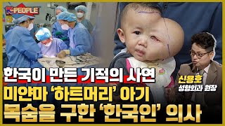 얼굴 혹 부풀어 '하트머리' 된 아기의 목숨을 구한 한국인 의사, 생명을 구한 기적의 사연은?