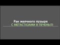 Историяпациента с раком желчного пузыря и метастазами в печени (часть#2)