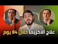 دكتور صالح دحدوح علاج الاكزيما في 84 يوم
