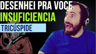 Insuficiencia tricuspide como voce nunca viu