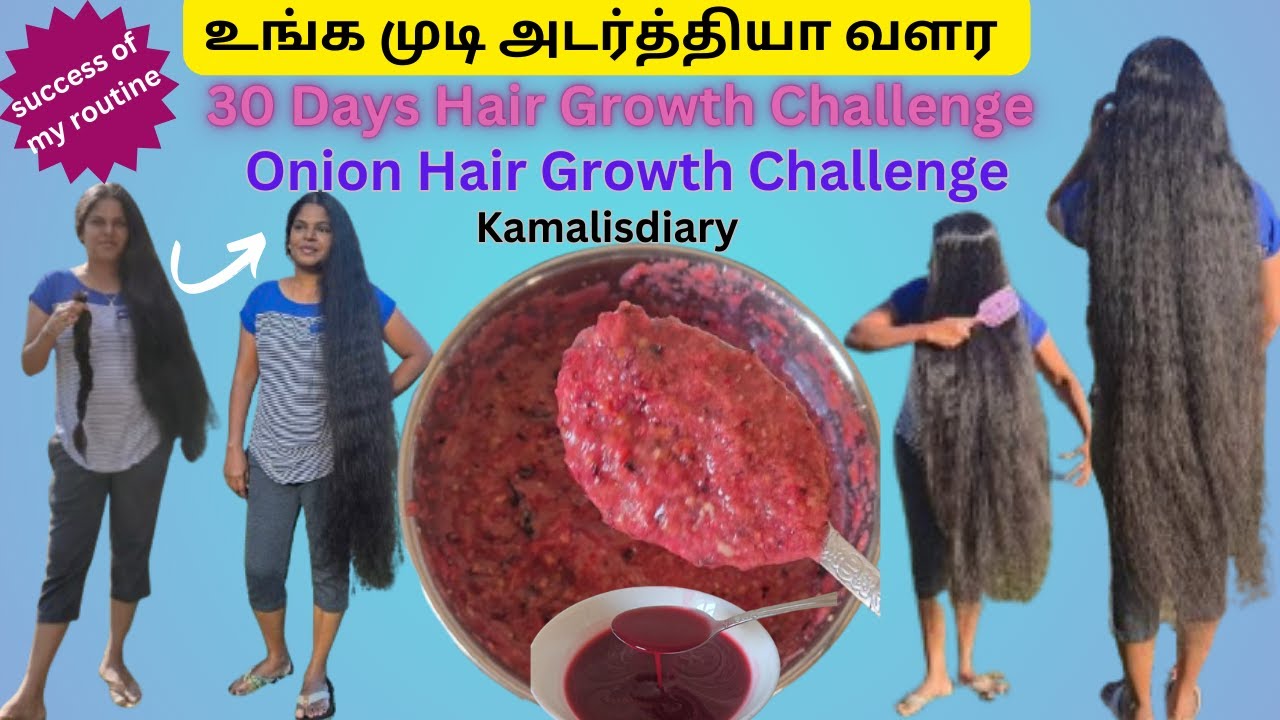 Onion hair growth challenge for 30 days/How to reduce hair fall and grow new hair 