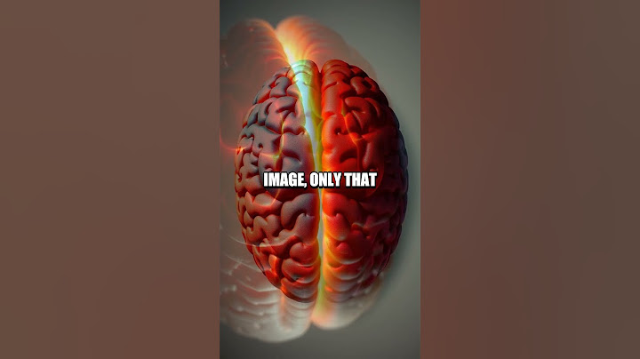 The Untold Story of the Split-Brain Experiment