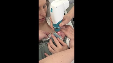 Examination of the fundus of the eye of preterm infants in skin-to-skin contact