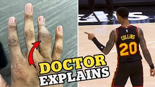 John Collins Finger Does Not Look Good  Doctor Explains Injury