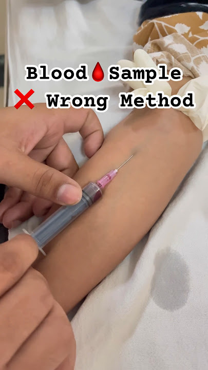 Blood🩸Sample || Taking Blood Sample || #bloodsample #nursing #medical #shorts #short #viral #nurses