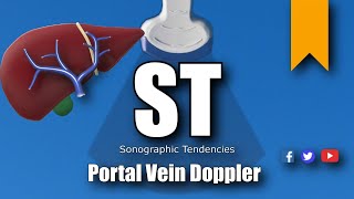 Portal Vein Doppler Protocol