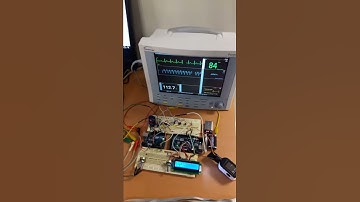 Simulador de pacientes con arduino