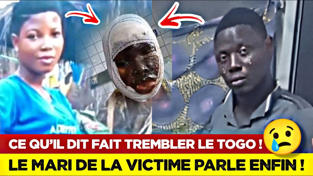 🚨LE MARI DE LA FILLE DÉTRUITE PAR ACIDE PREND LA PAROLE & DÉVOILE TOUT ! 😢💔🇹🇬