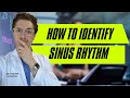 How to identify sinus rhythm on ecg