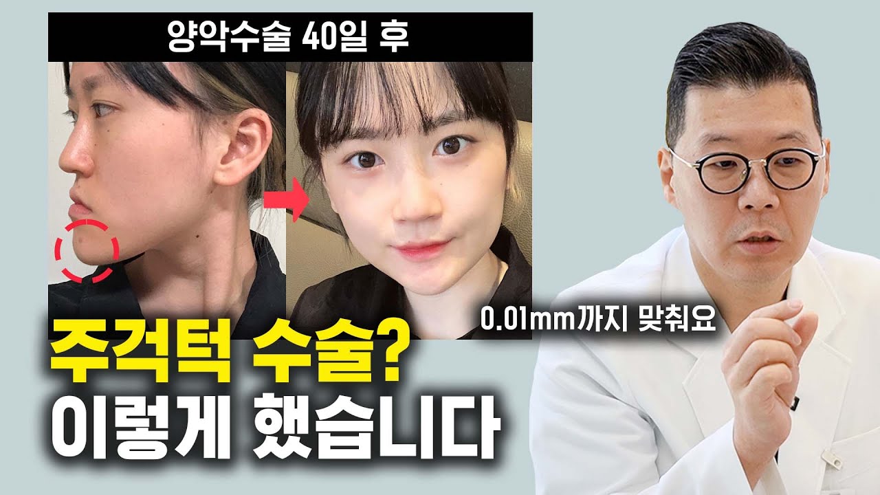 안면 비대칭 수술에 대한 자세한 양악 수술 리뷰를 살펴보겠습니다. 9