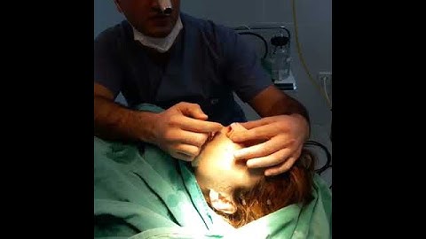 Bakida burun emeliyyatlari qiymeti Dr. Farid Aliyev