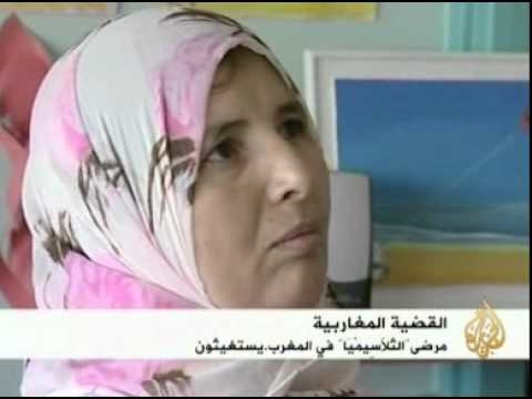 قرار يمنع فوق 15عاما من علاج التلاسيميا بالمغرب