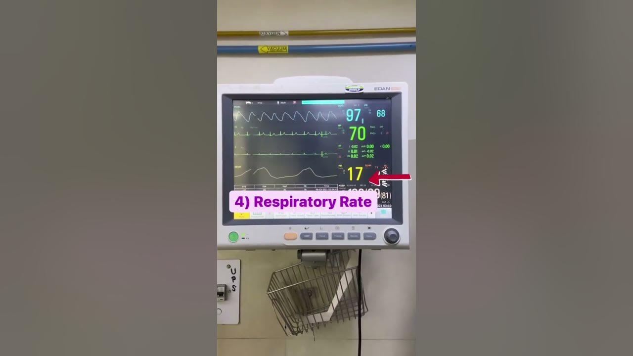 Basic to reading a patient's Monitor 🎞️ (ICCU)