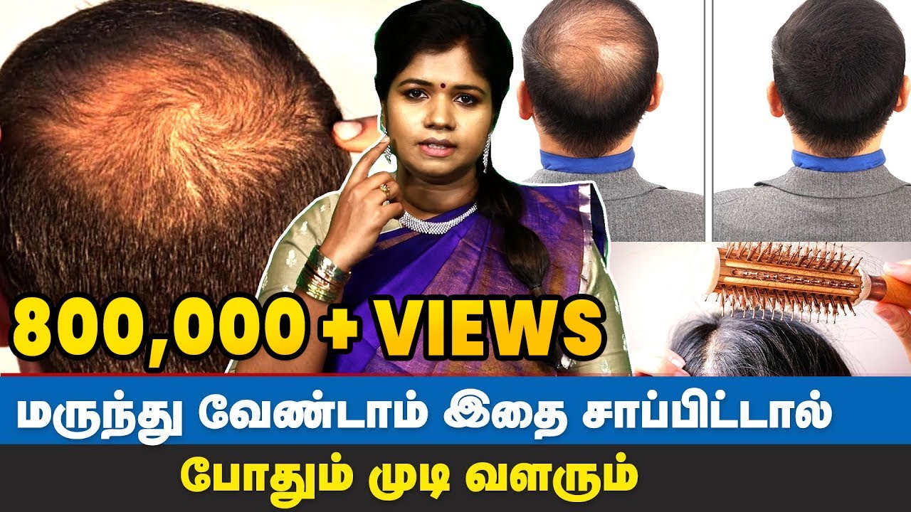 இதை பின்பற்றினா போதும் கொட்டுன முடி திரும்ப வளரும் | Hair Regrowth Tips Tamil | Dr Yogavidhya
