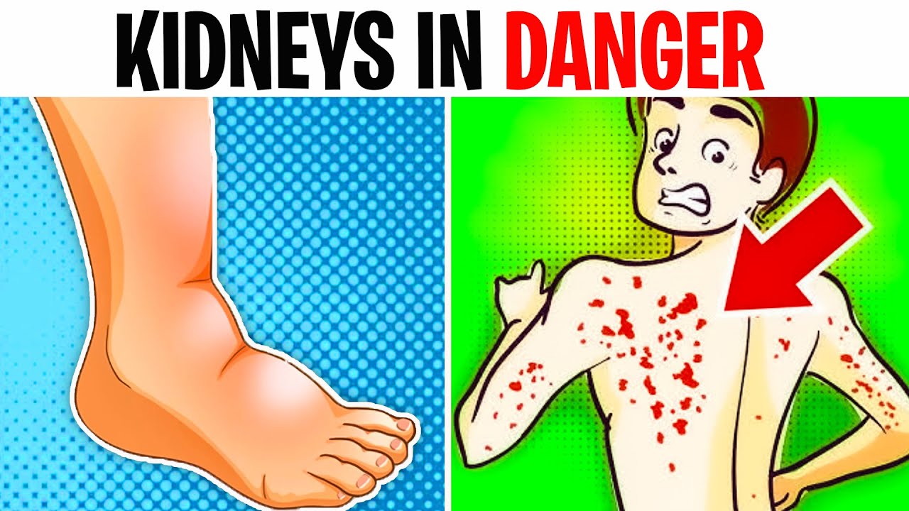 10 signs your kidneys are crying for help youtube