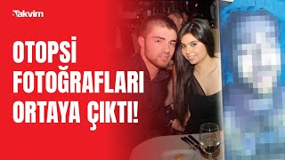 Cem Garipoğlu’nun otopsi görüntüleri ne anlatıyor? işte detaylar... Resimi