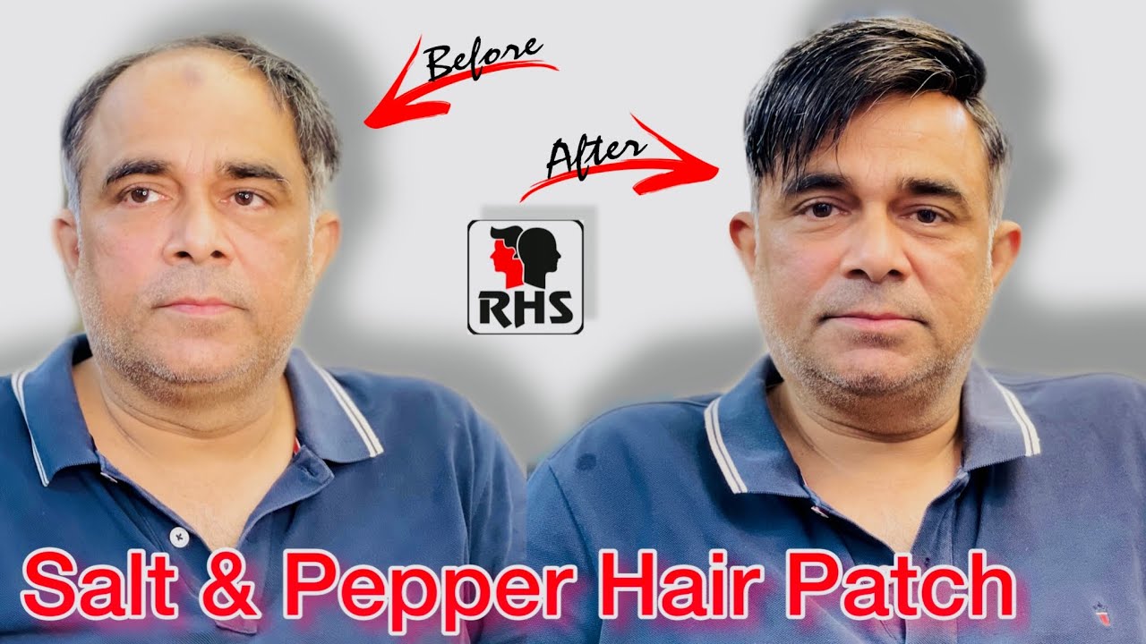 Salt and Pepper Hair Patch Hair Transformation Hair Patches For Men