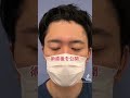 メンズの眉下リフト☆術直後☆