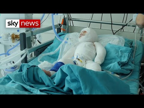 War in Syria: The toddler fighting for her life
