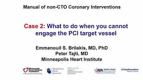 Case 2: PCI Manual - What to do when you cannot engage the PCI target vessel