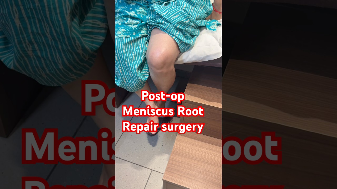 Meniscus Surgery rehab 