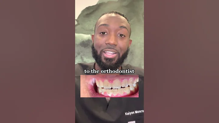 Avoid Yellow Stains with Braces! #shorts