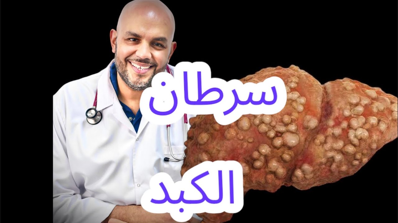 سرطان الكبد / Cancer liver