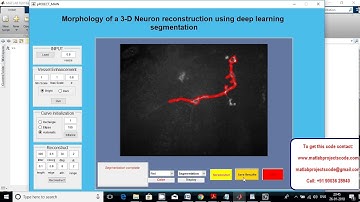 Matlab code for Morphology of a 3-D neuron reconstruction using deep learning segmentation