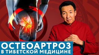 КАК тибетская медицина поможет при АРТРОЗЕ // #чжудши #тибетскаямедицина #артроз